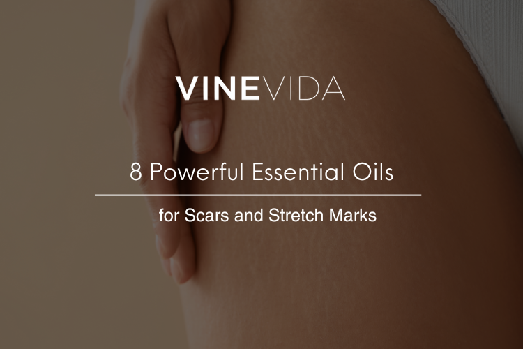 8 Powerful Essential Oils for Scars and Stretch Marks