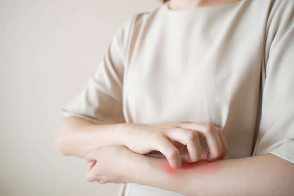What are the Best Carrier Oils for Eczema: A Comprehensive Guide