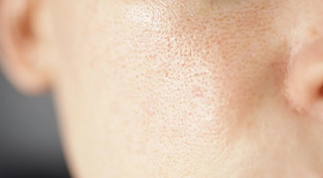 Complete Comedogenic Scale for Carrier Oils & Beauty Butters