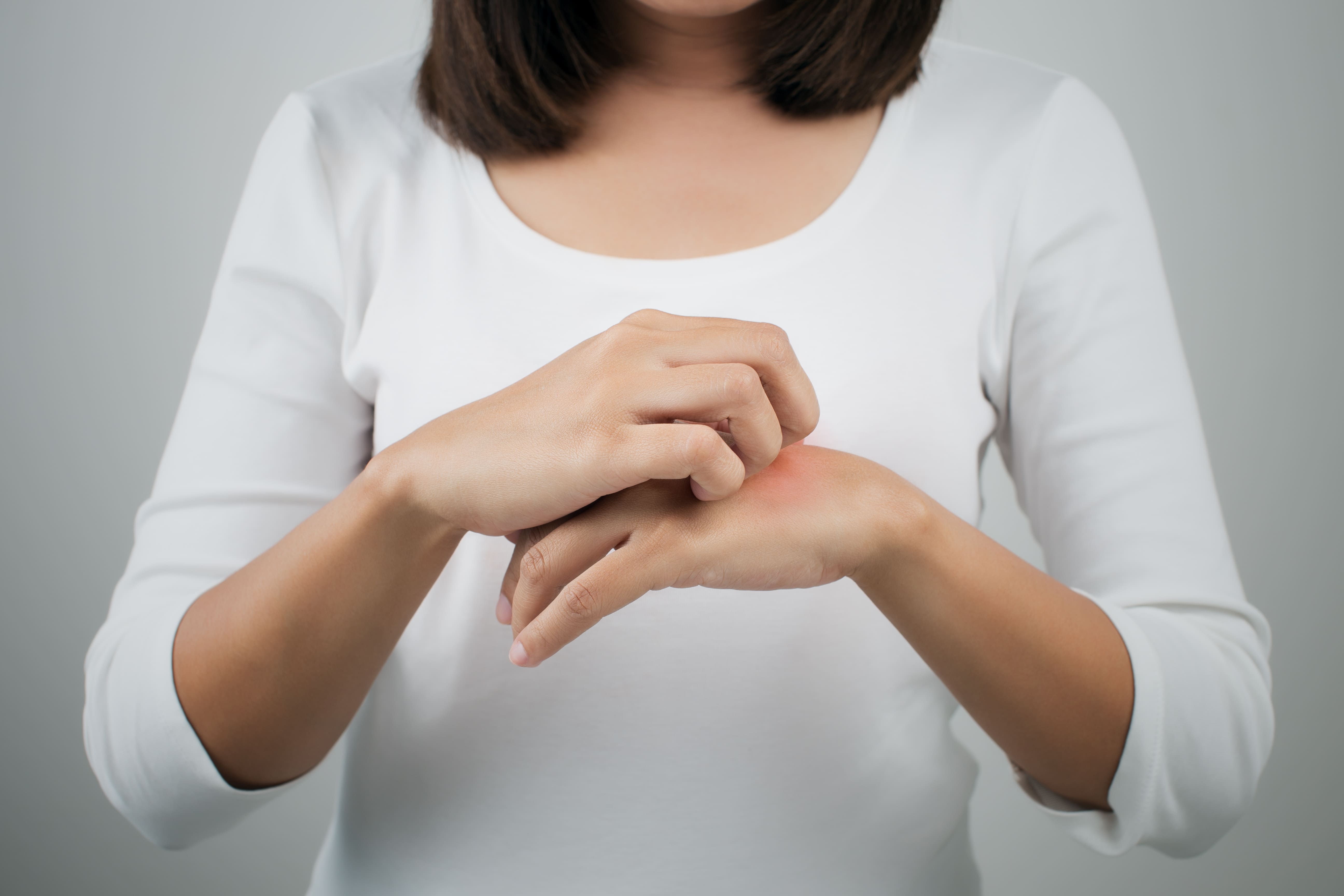 Essential Oils for Itchy Skin: Soothing Recipe & Remedies